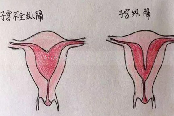 无法生育的夫妻如何拥有自己的孩子？该如何应对这个难题？